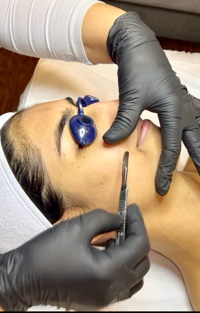 Dermaplaning facial