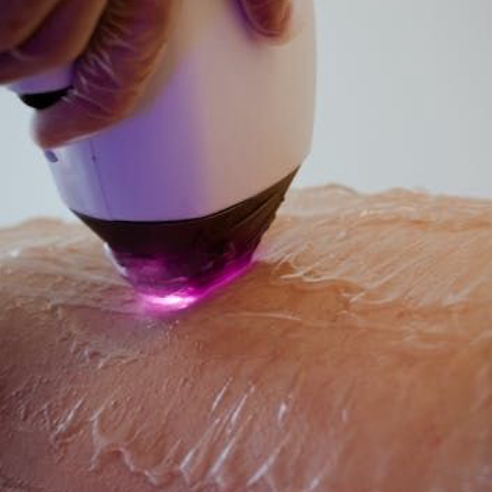 Medium Area at MySkin Aesthetics in Laredo, TX