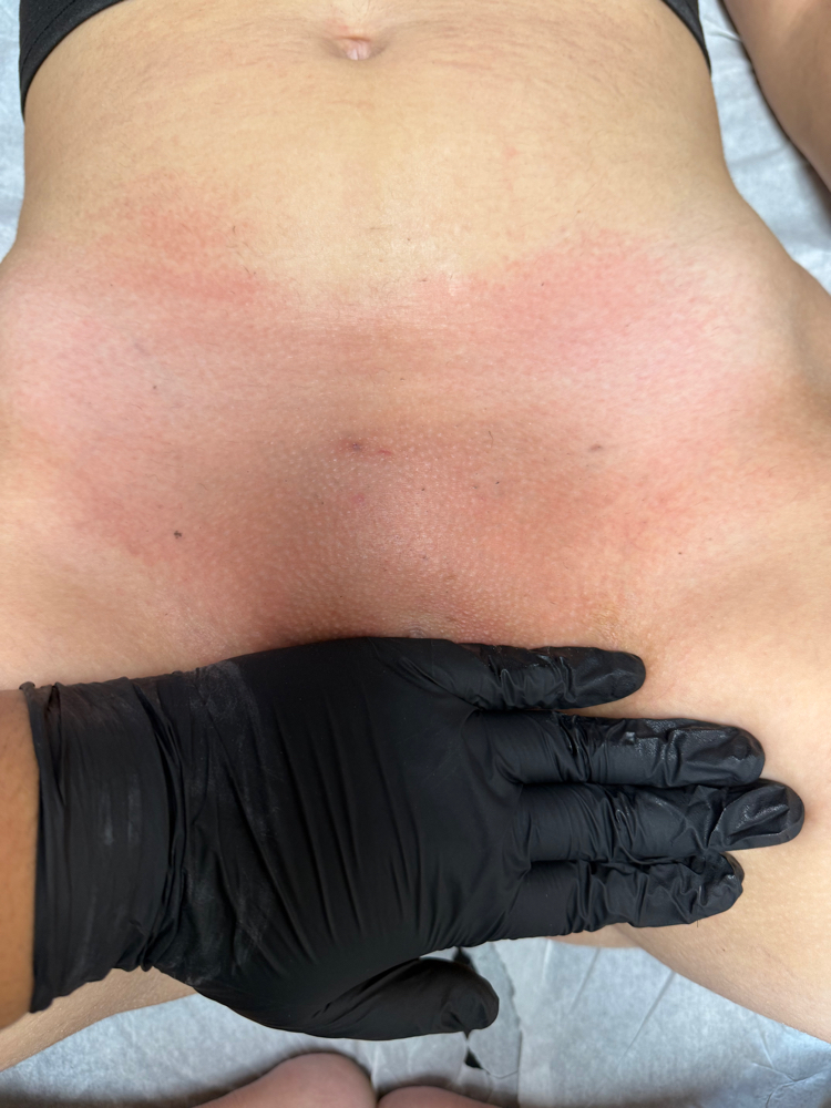 Brazilian & Butt Strip at SixteenSkn in San Antonio, TX