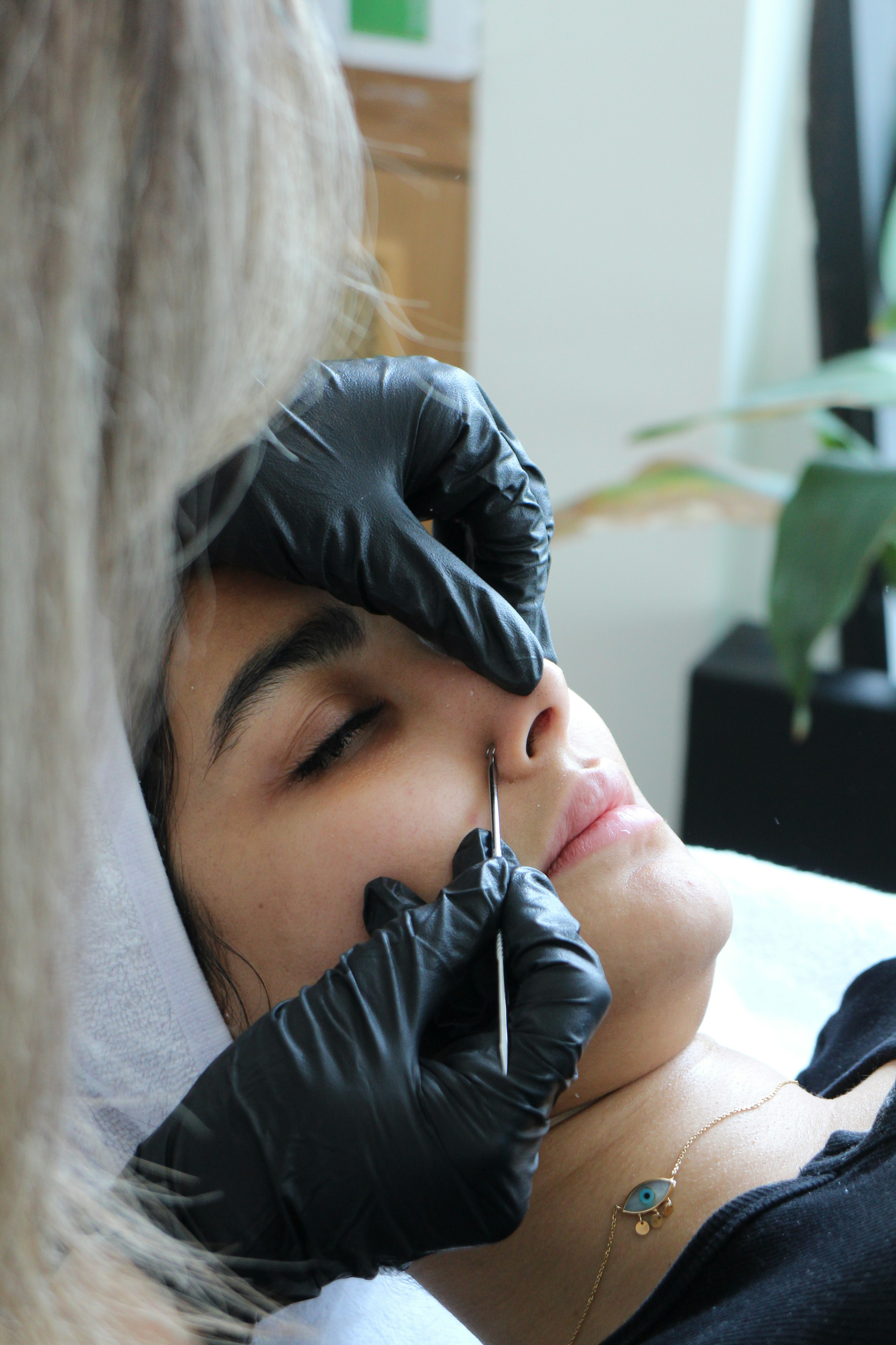 Extractions at AV Esthetique in Highland Park, IL