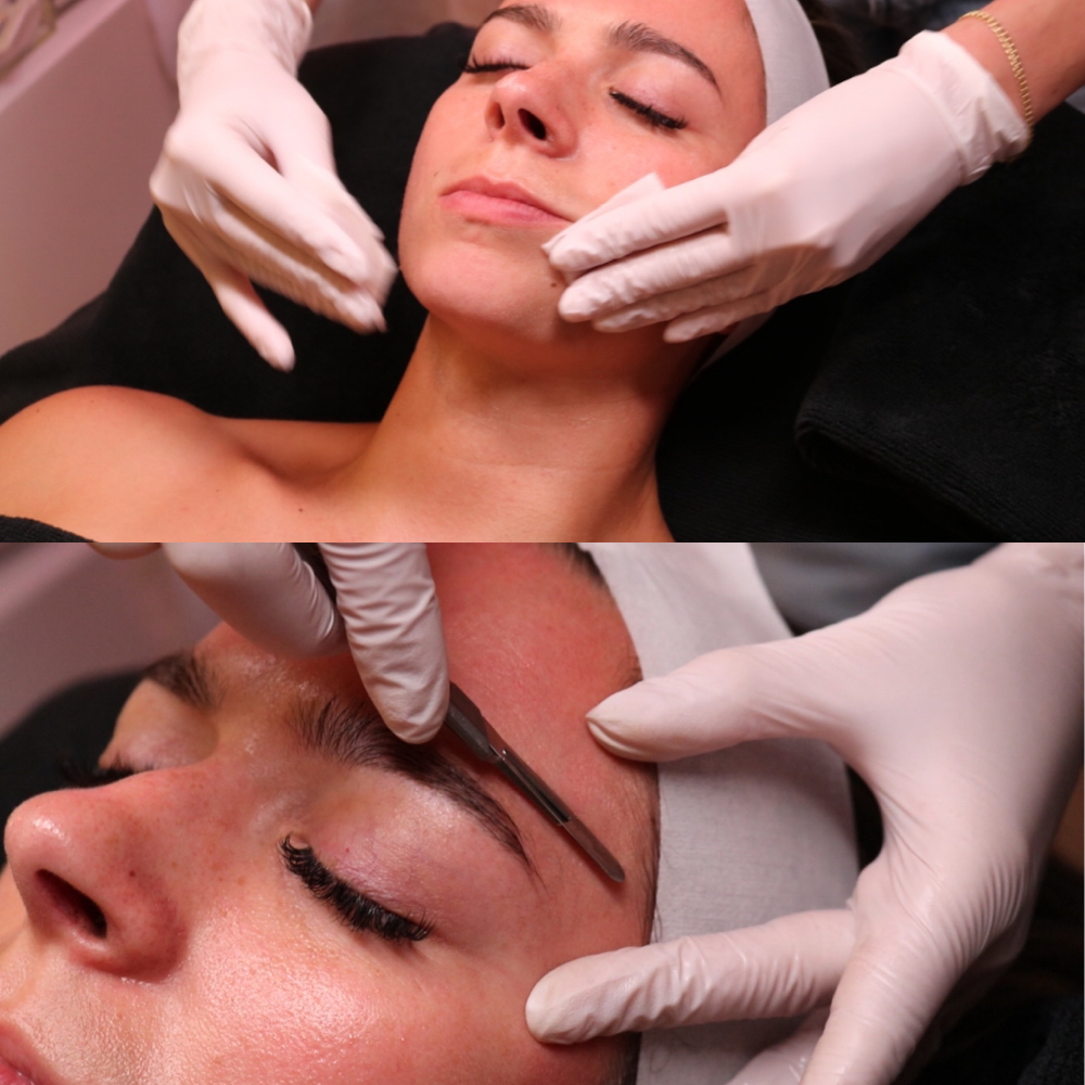 Express Dermaplane