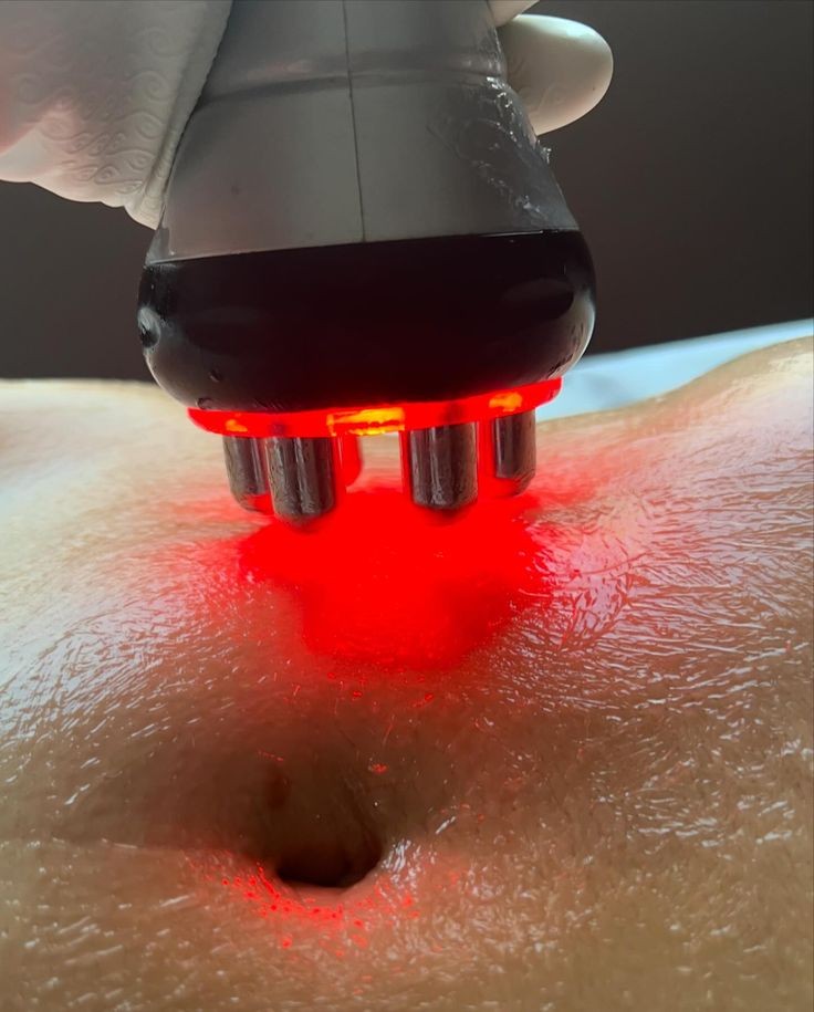 Body Sculpting Touch Ups