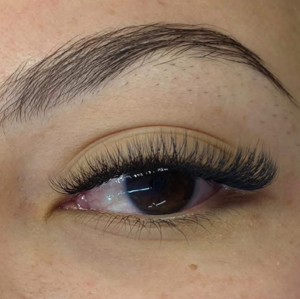 Soft Volume at Belleza Naturalé Aesthetics in Milwaukee, WI