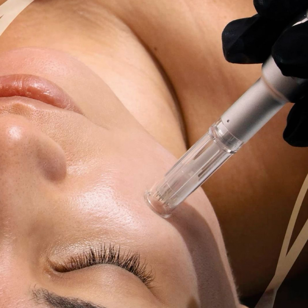 Skin Transformation Duo at Everlasting Aesthetics LLC in Surprise, AZ