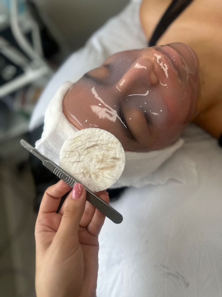 Dermaplaning