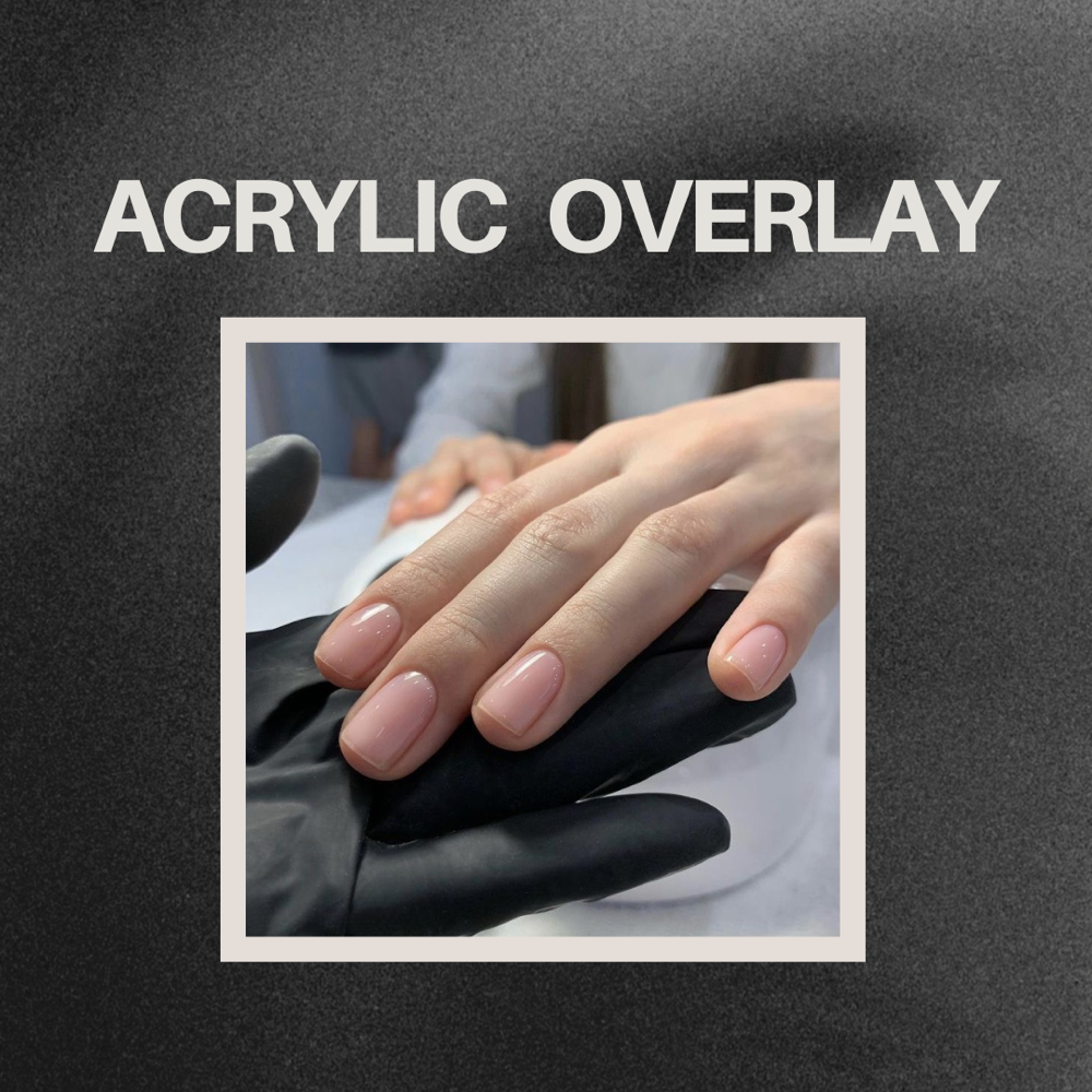 Acrylic Overlay