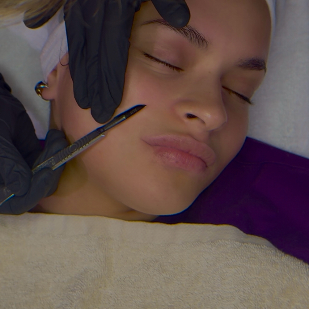 Dermaplane Add On ONLY at Pure Elegance Esthetics in North Andover, MA