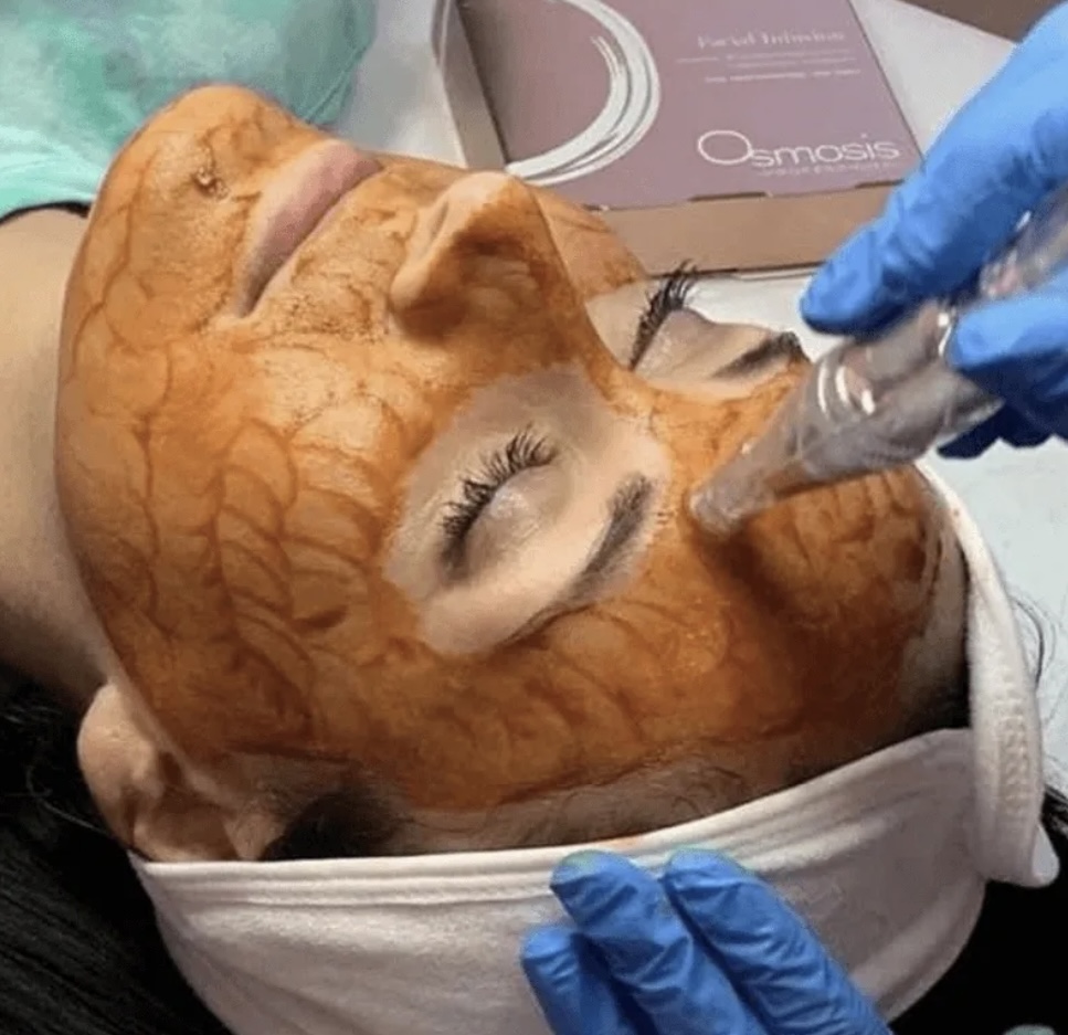 Osmosis MD Facial Infusion