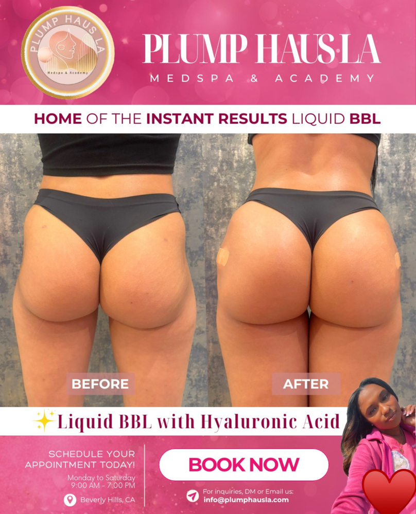 Last Chance $997 (300 MLS) No Hips