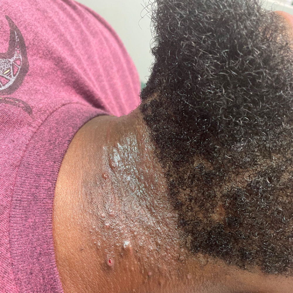 Mens Neck Wax at SKYNSENSE in Pikesville, MD