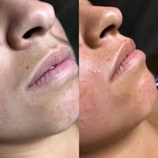 Lip Wax