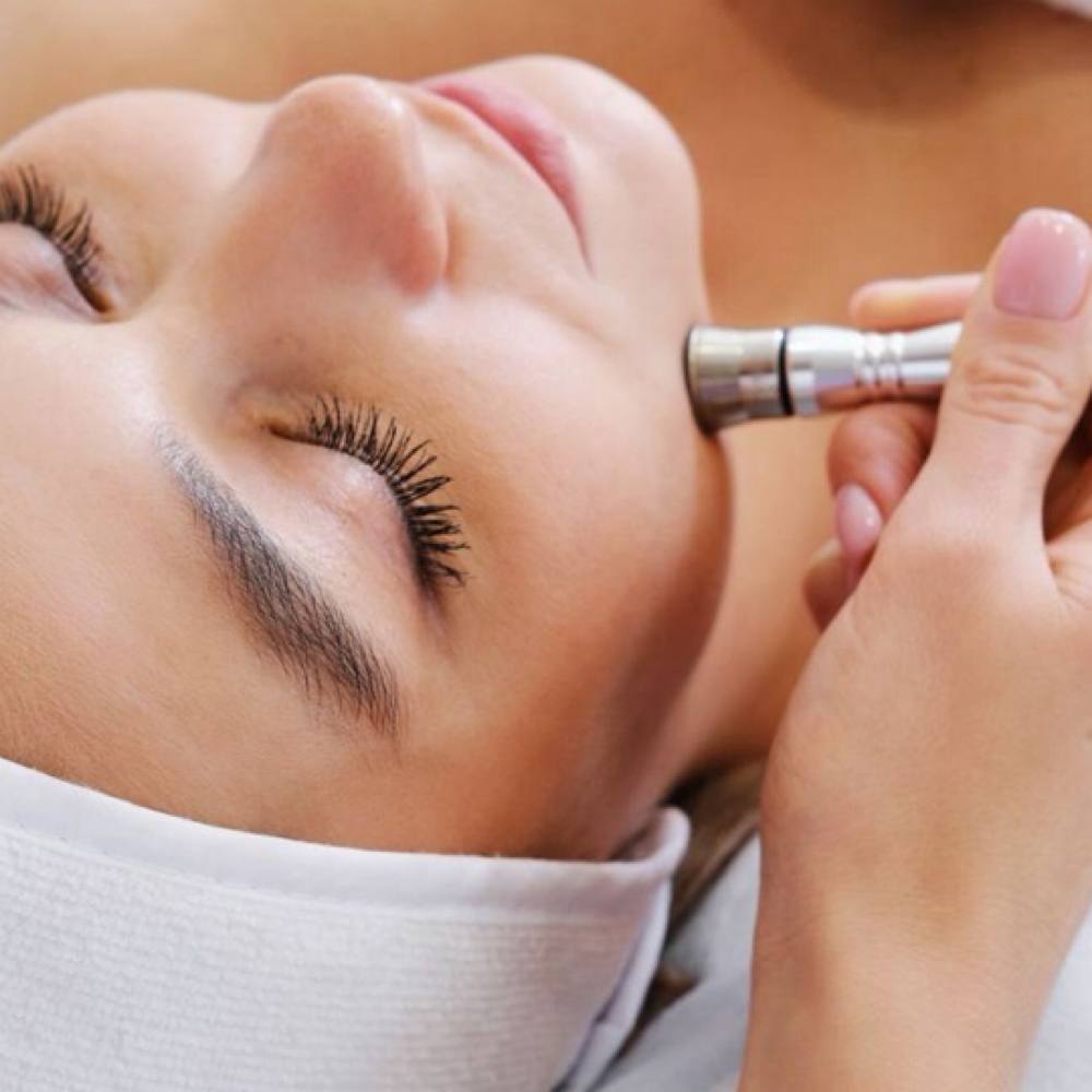 Microdermabrasion Facial at Kenzy.esthetics in Hobart, IN