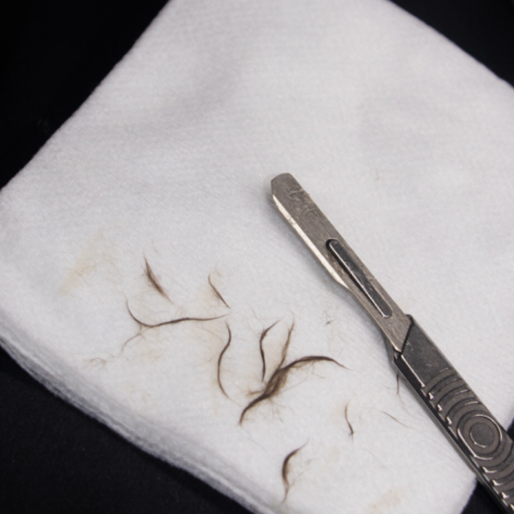 Bare Skin Facial at North Bama Esthetics in Albertville, AL