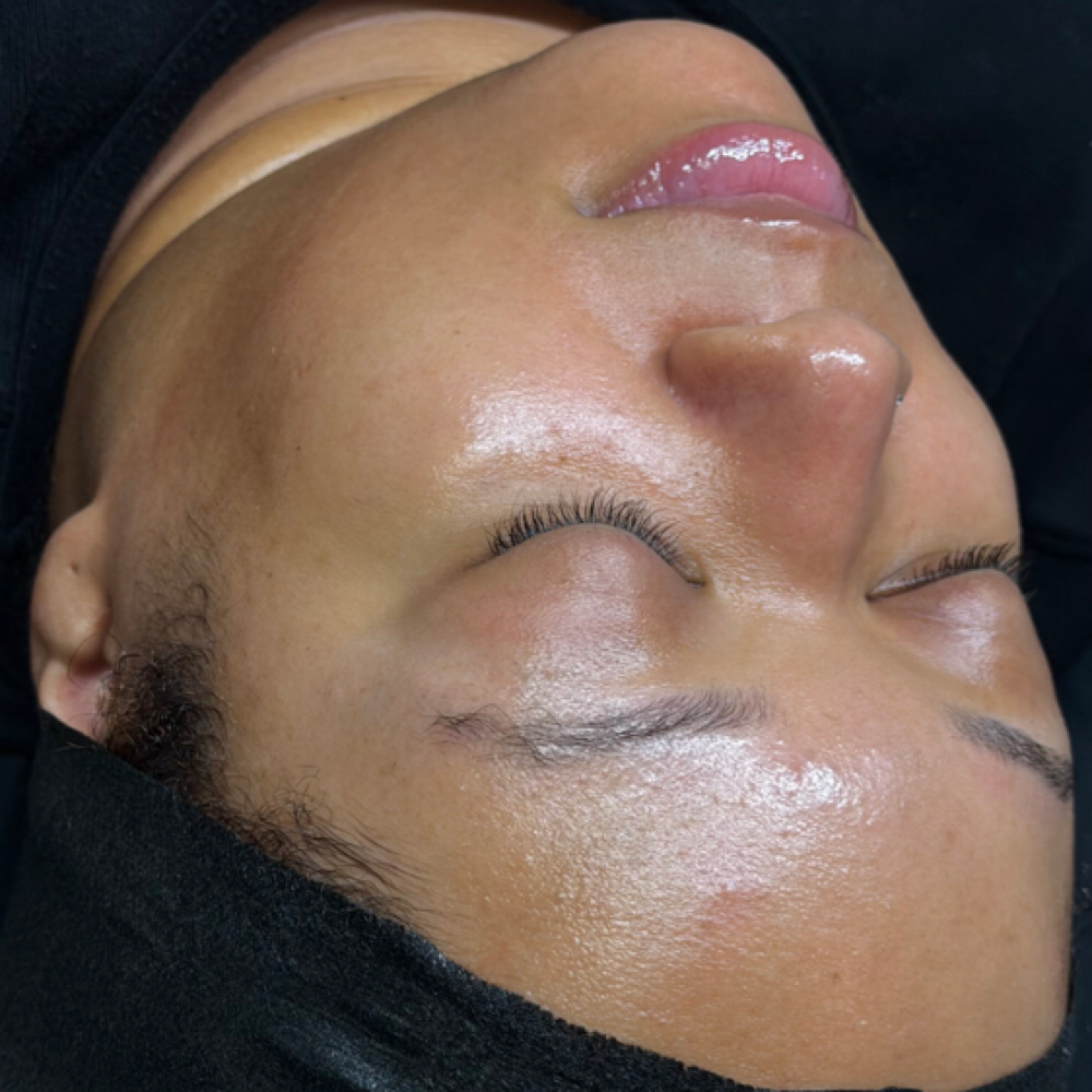 NEW CLIENT $95 ALL INCLUSIVE FACIAL at Aeterna Radiance Aesthetics in Poughkeepsie, NY