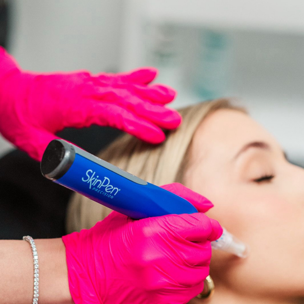 SkinPen® Microneedling at Everlasting Aesthetics LLC in Surprise, AZ