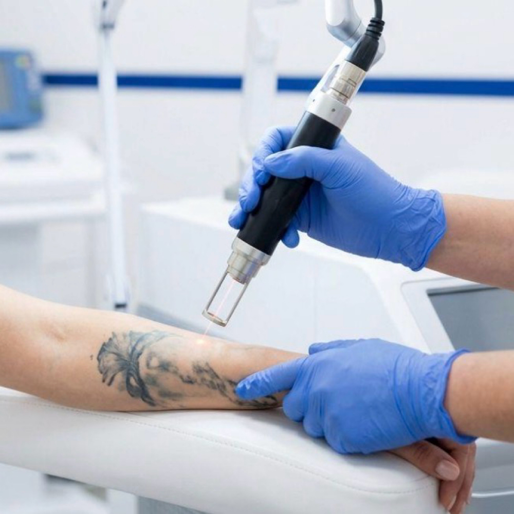 Tattoo Removal (starting At) at La Belle Studio by Soraya in Woburn, MA