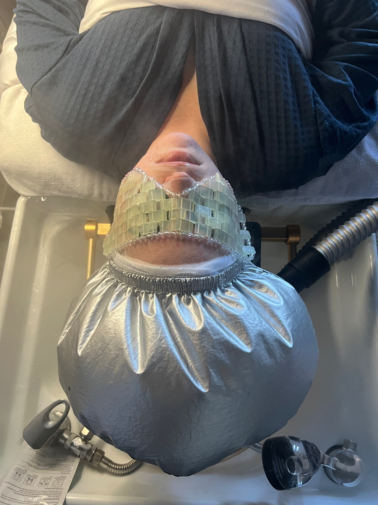 Psoriasis Scalp Treatment