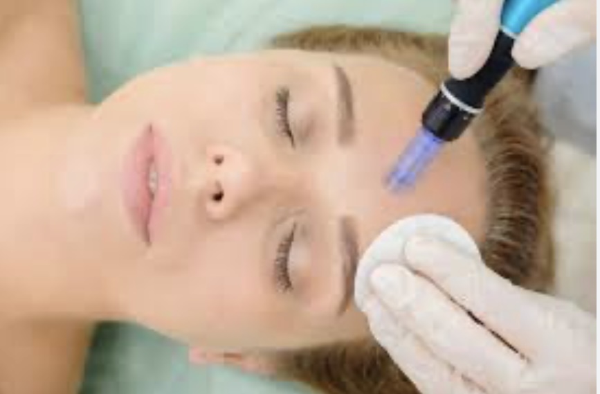 Microneedling With Dr.pen