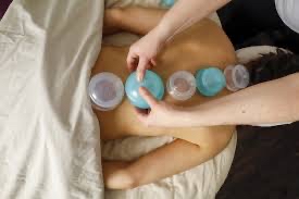 Cupping Therapy