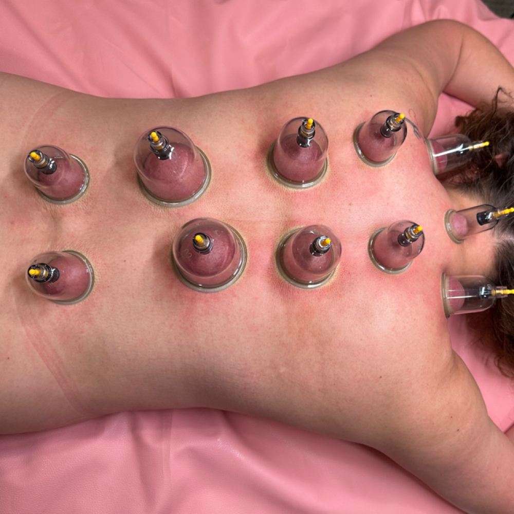 Cupping Therapy / Terapia De Ventos at Skin By Peaches in Duluth, GA