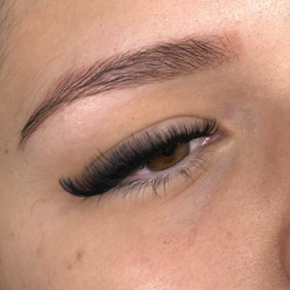 Volume Set at Amor Esthetics in Goodyear, AZ