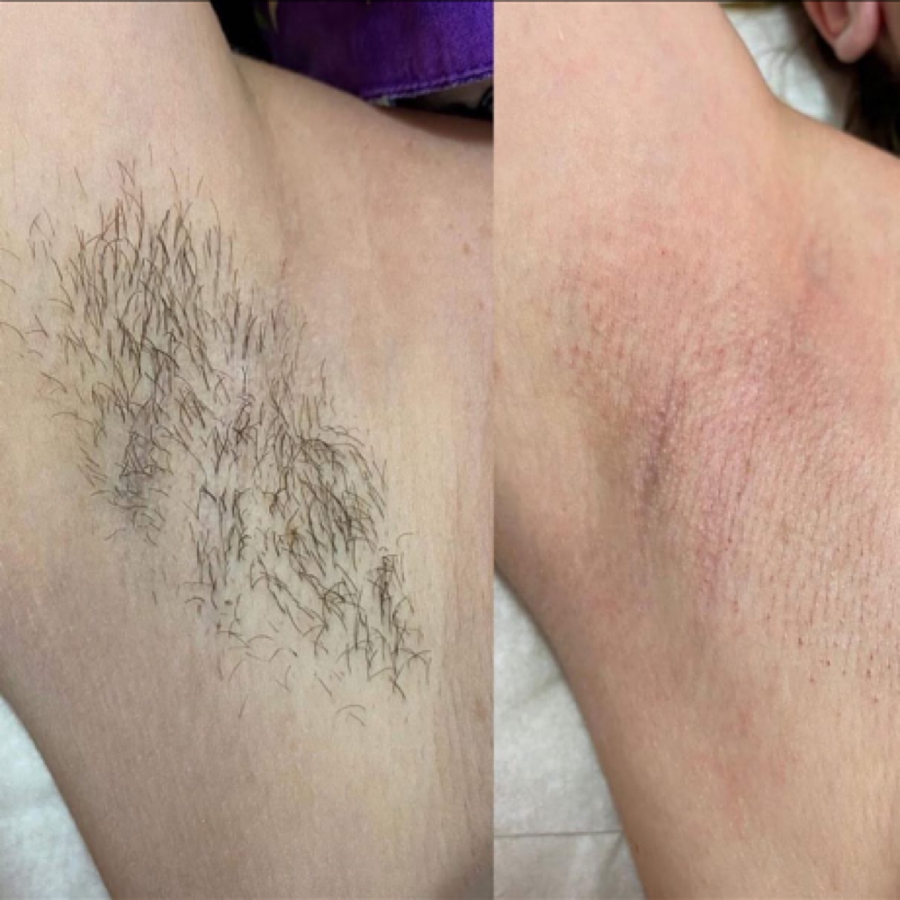 Under Arm Wax at Bare Beauty By Alexis in Bay Saint Louis, MS