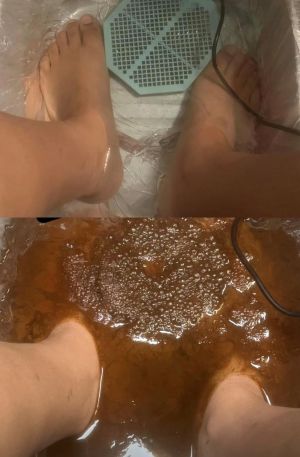 Ionic Foot Detox