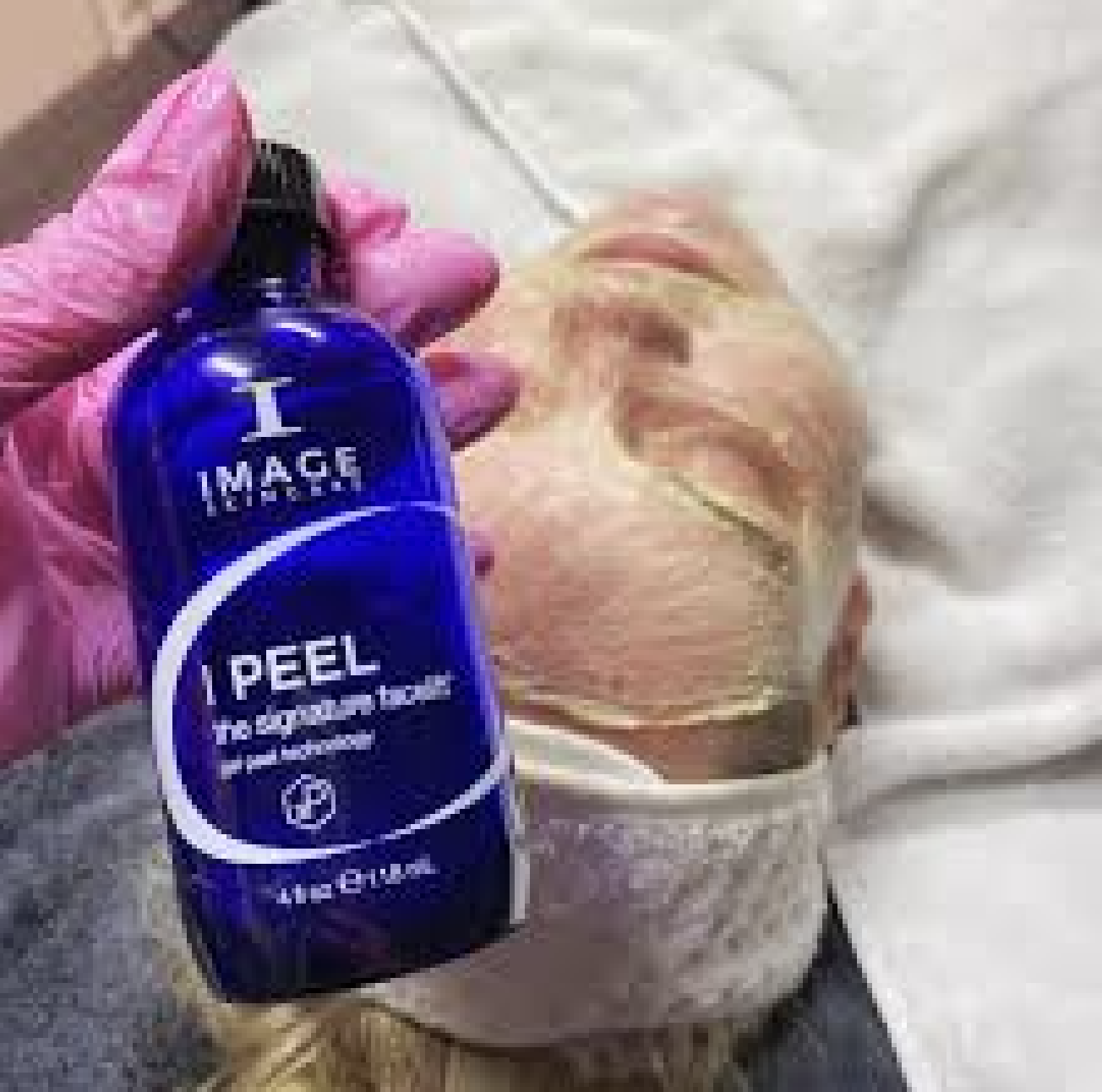 Signature Peel Treatment