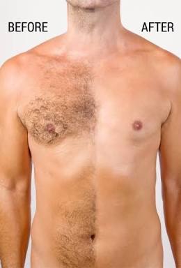 Chest Wax