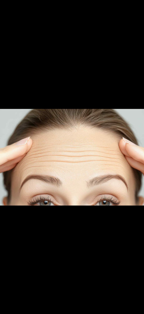 Forehead at Lush MedSpa & IV Lounge in Middlesboro, KY