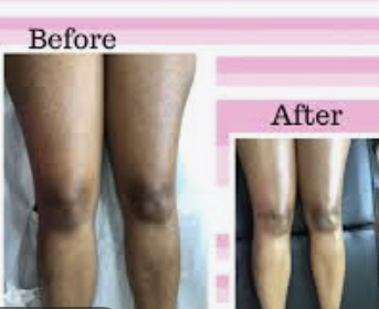 Lower Leg & Thigh Wax