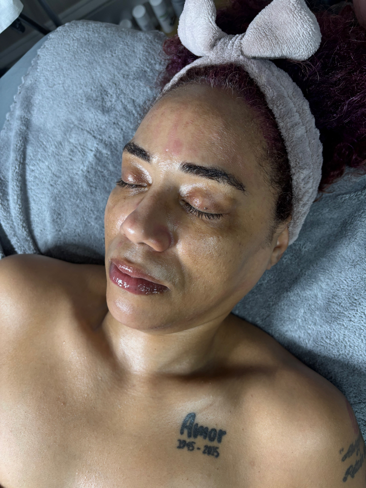 Dermaplaning Add-On