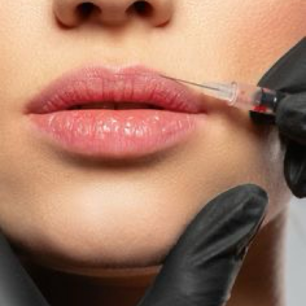 Lip Flip at The Skin Room Aesthetic and Wellness LLC in Longview, TX
