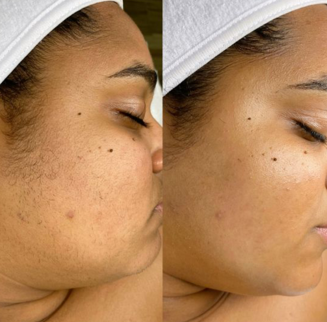 Full Face Wax at Jontahontas’ Collection LLC. in Greenville, SC