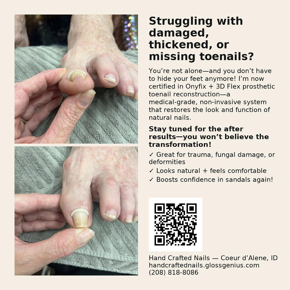 Signature Onyfix® Correction Band