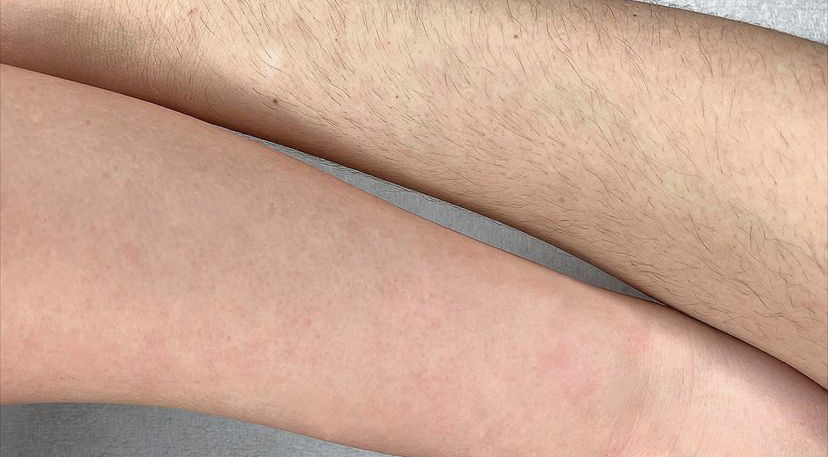 Half Arm Wax at Your Esti Bestie Via in Overland Park, KS