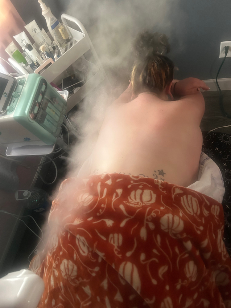 Back Facial at Skin Spells Esthetics in Roscoe, IL