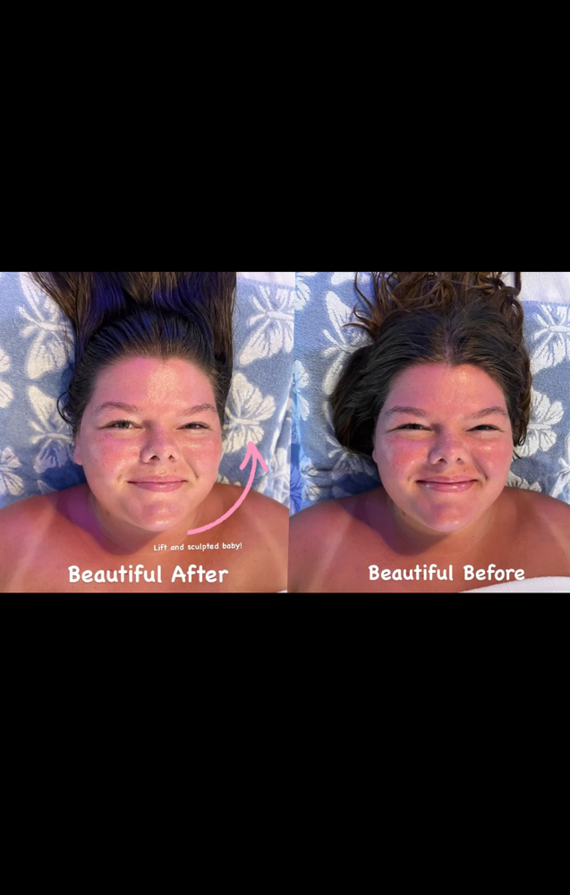 Express Buccal Massage – 30 min