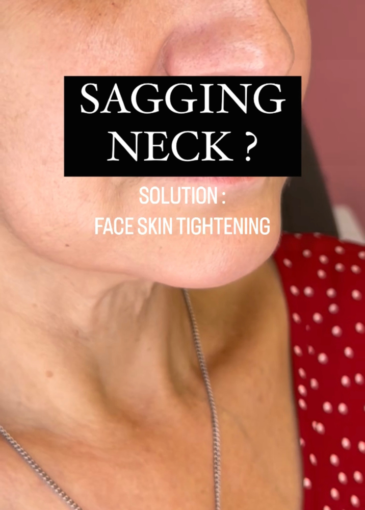 3 Face Skin Tightening sessions