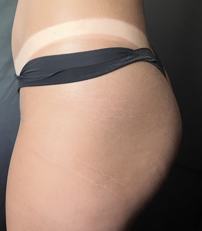Spray Tanning