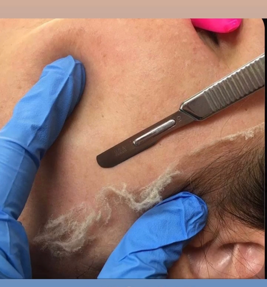 Dermaplane