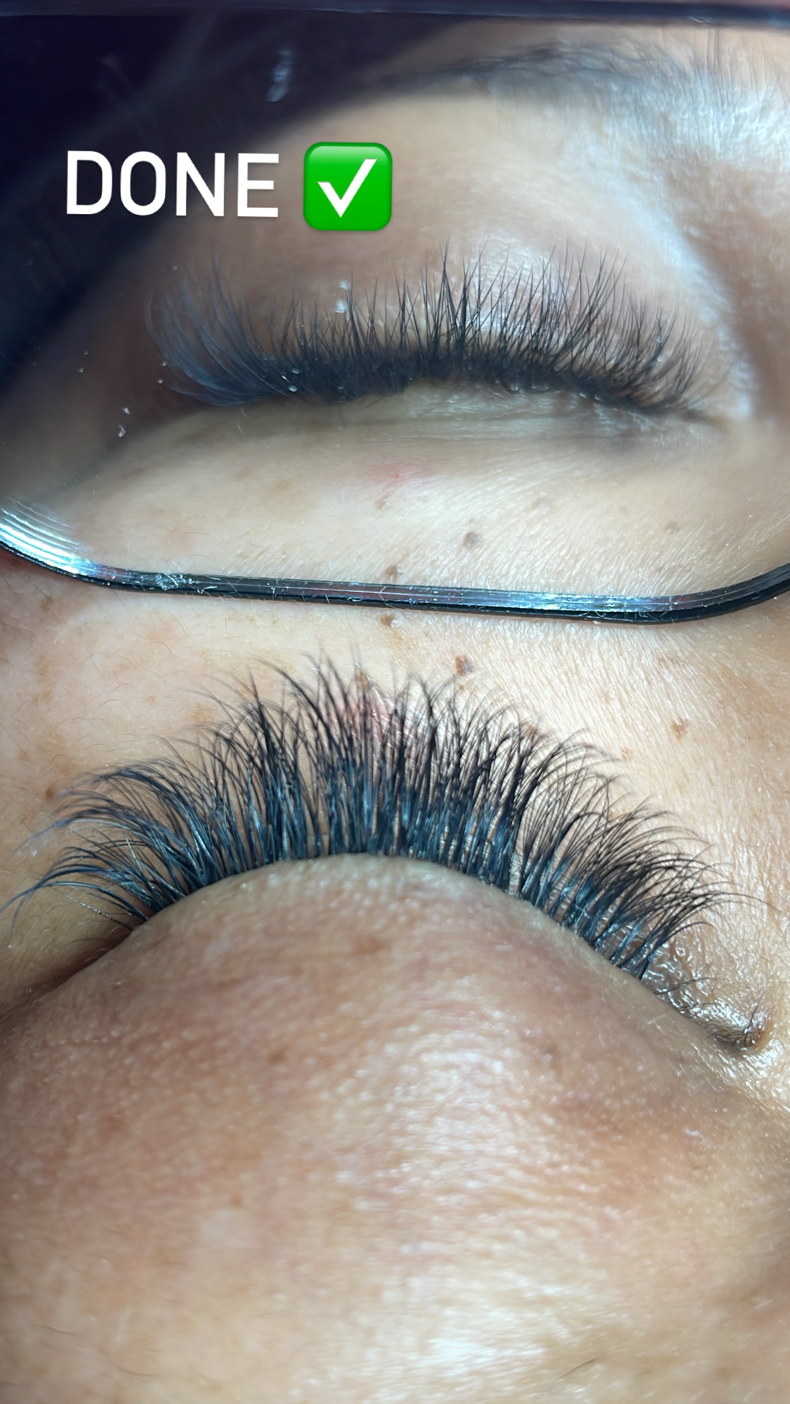 Hybrid 2-3 week fill