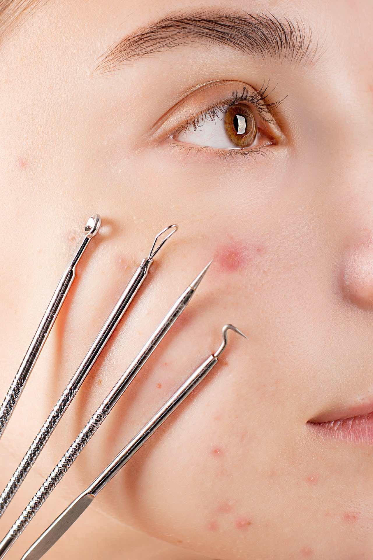 EXTRACTIONS