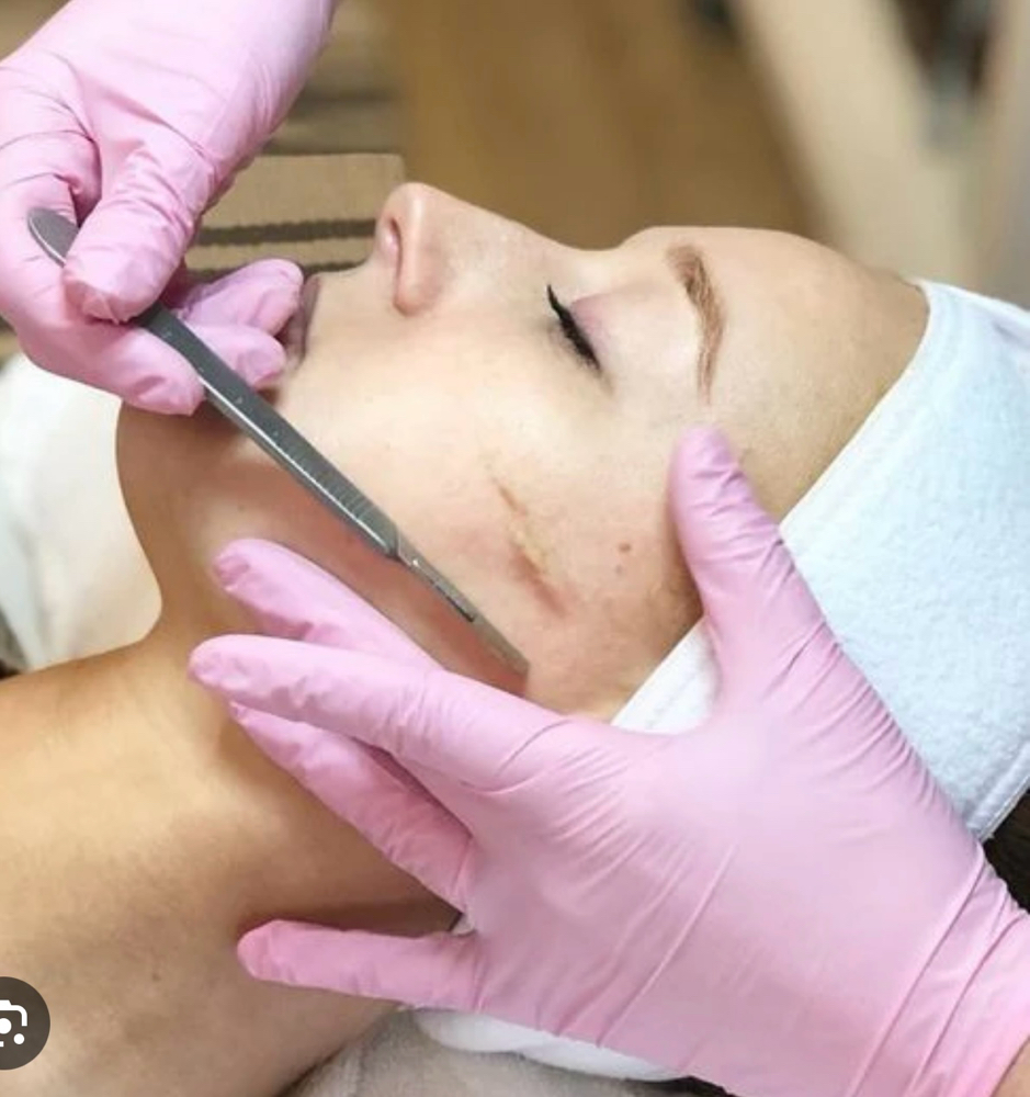 DERMAPLANING ADD-ON ONLY