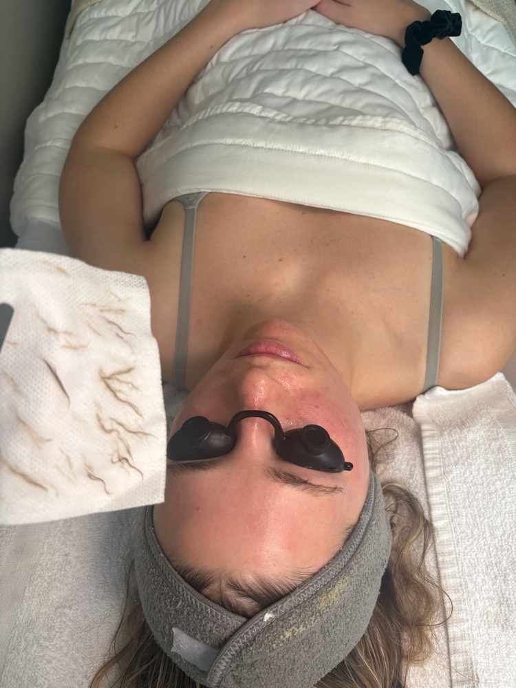 Summer Skin Rescue Facial