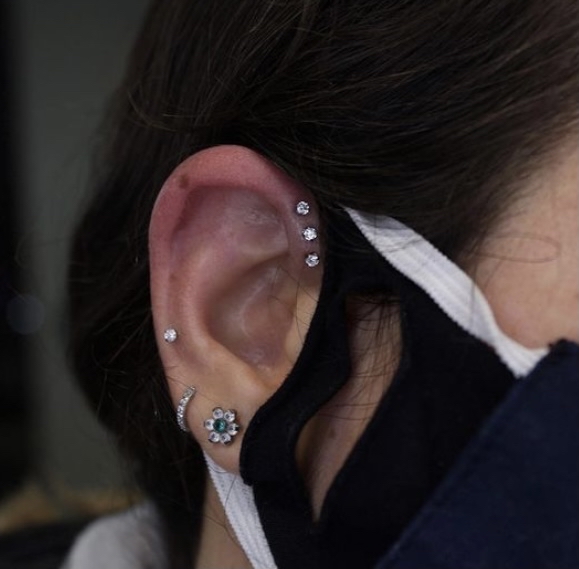 Forward helix (1)