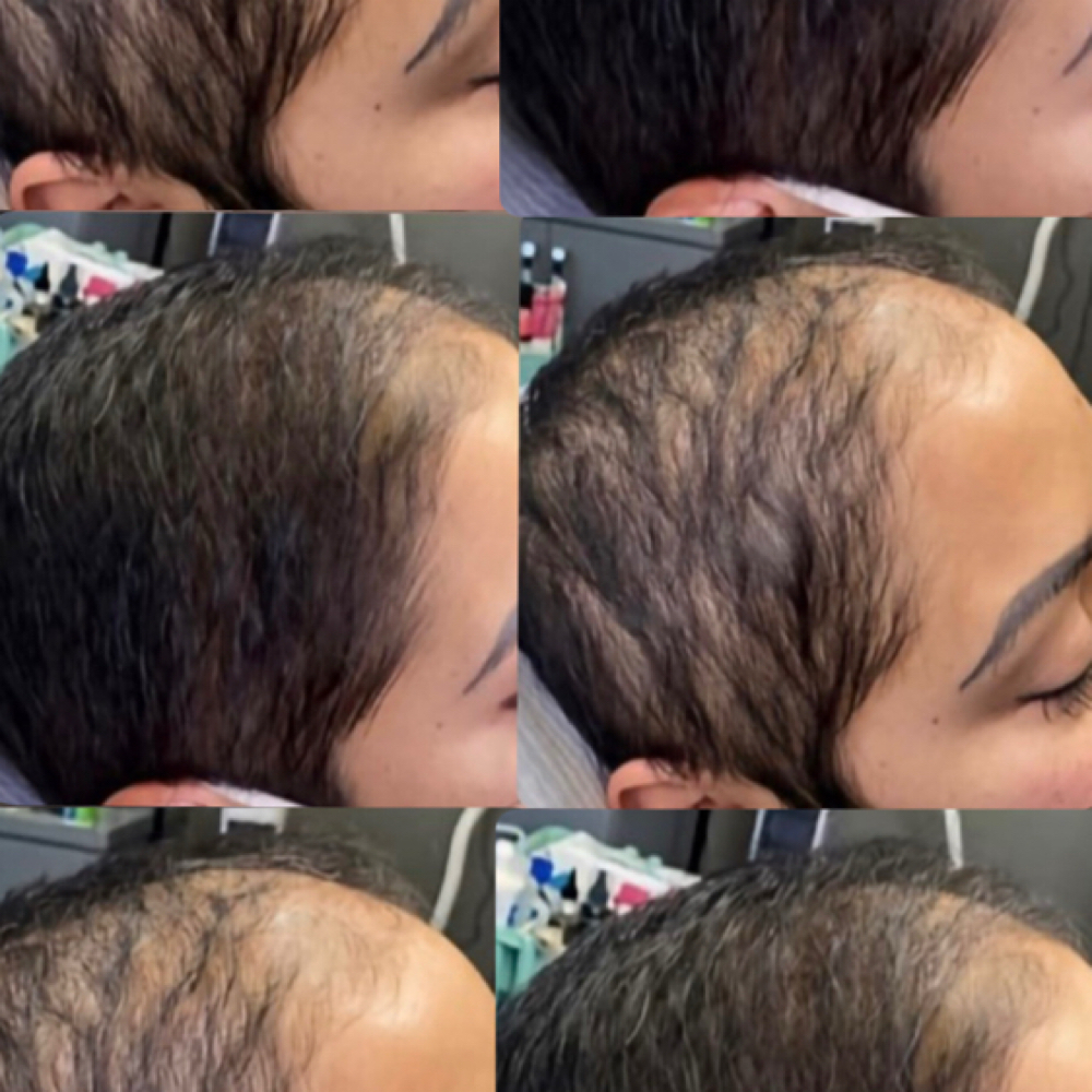 Hair Regrowth GrowthBoost(Exosomes) at It’s Your Beauty Time in Downey, CA