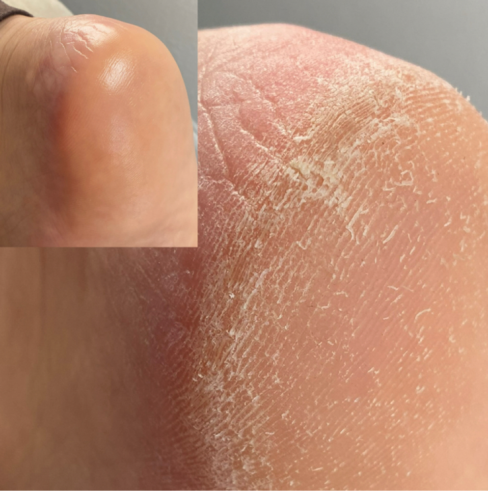 DRY PEDICURE CLASS at THE BEAUTY CAVE LLC in Lehigh Acres, FL