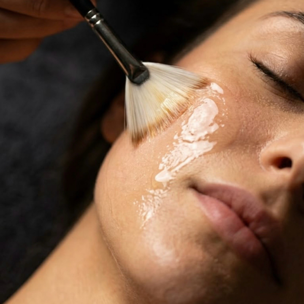 Facial with chemical peel at LM BEAUTY AESTHETICS in Everett, MA