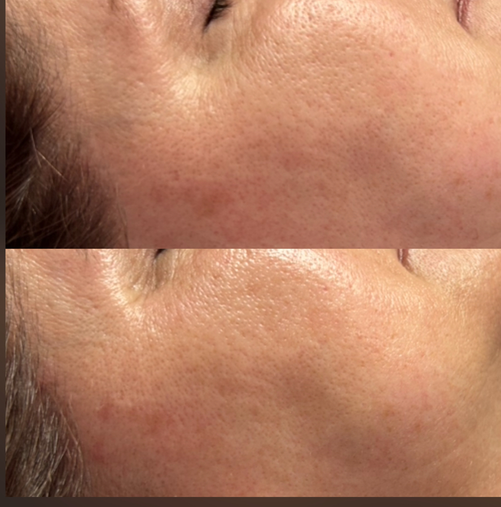 Factor Five Peel • Human Stem Cells